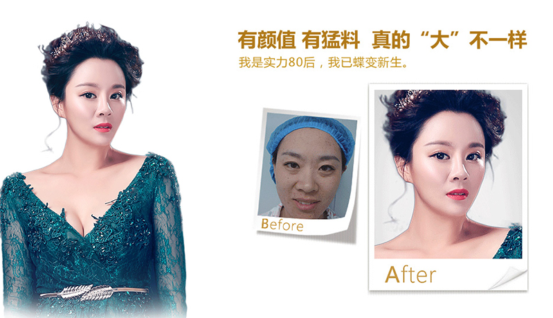 张家界脂肪移植、隆鼻