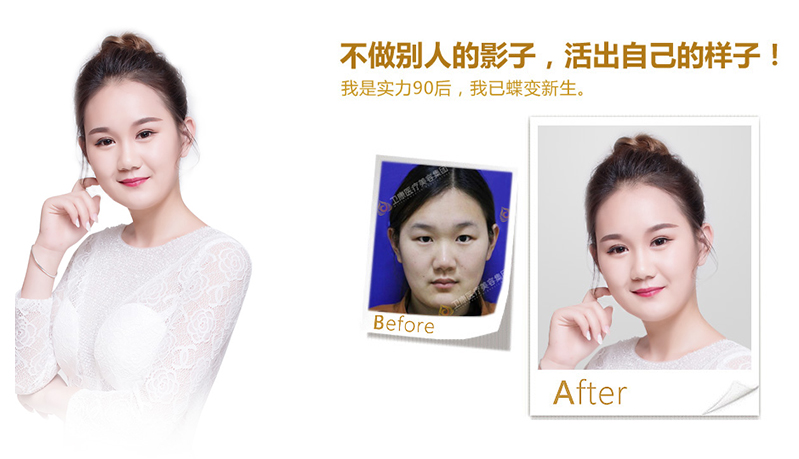 张家界纳米脂肪移植