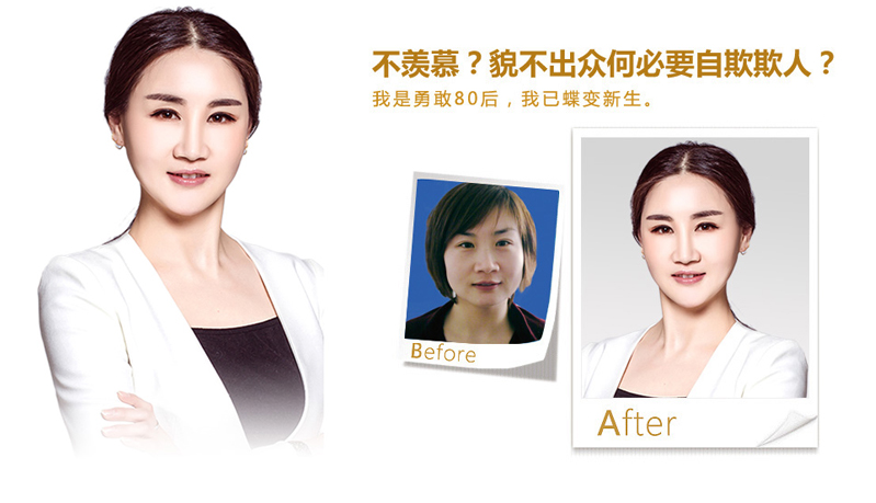 张家界注射微雕