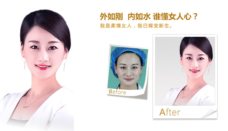 张家界V脸、线雕隆鼻